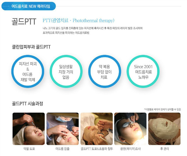 골드ptt.JPG